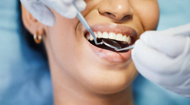 Best Orthodontic Emergency Dentist in West Burlington, IA