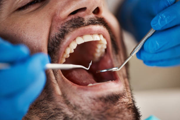 Best Emergency Dentist for Special Needs Patients in West Burlington, IA